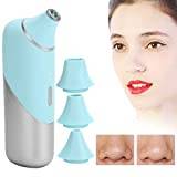 Blackhead Vacuum Remover, Visual Blackhead Removal Machine, Electric Smart WIFI Vacuum Suction Face Pore Cleaner, Blackhead Extractor Tool for Women and Men(Green)