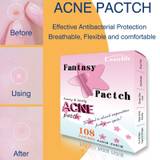 108 patches star acnes pimple patch sticker waterproof acnes pimple remover tool