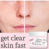 Blemish Treatments on sale mummy pregnant acne lotion get clear radiant skin fast working