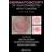 Dermatoscopy of Non-Pigmented Skin Tumors: Pink - Think - Blink (Hardcover, 2015)