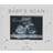 Bambino Resin baby scan 4 3", babyshower, parents to be gift Photo Frame